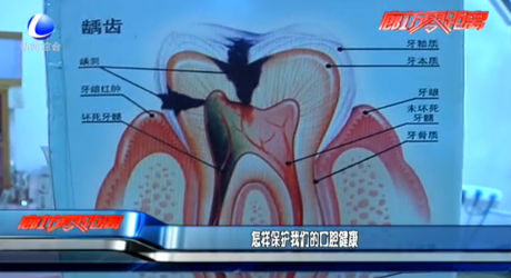 怎樣保護我們的口腔健康