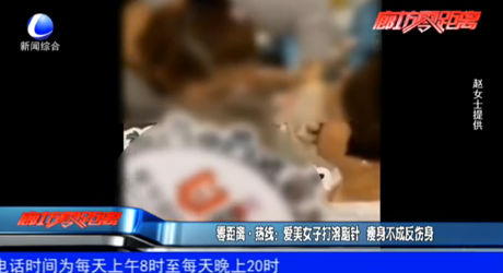 零距離熱線：愛(ài)美女子打溶脂針 瘦身不成反傷身